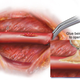Image for article titled This New Worm-Inspired Surgical Glue Can Mend Wet, Squishy Heart Tissue